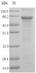 UAP1 Protein - (Tris-Glycine gel) Discontinuous SDS-PAGE (reduced) with 5% enrichment gel and 15% separation gel.
