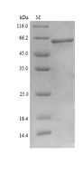 UAP1 Protein - (Tris-Glycine gel) Discontinuous SDS-PAGE (reduced) with 5% enrichment gel and 15% separation gel.