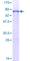 UAP1 Protein - 12.5% SDS-PAGE of human UAP1 stained with Coomassie Blue