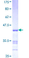 UAP1 Protein - 12.5% SDS-PAGE Stained with Coomassie Blue.