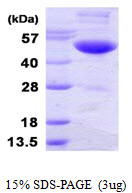UBA3 / UBE1C Protein