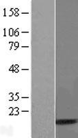 UBA52 Protein - Western validation with an anti-DDK antibody * L: Control HEK293 lysate R: Over-expression lysate