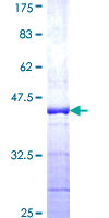 UBA52 Protein - 12.5% SDS-PAGE Stained with Coomassie Blue.