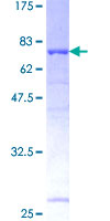 UBAC1 / KPC2 Protein - 12.5% SDS-PAGE of human UBADC1 stained with Coomassie Blue