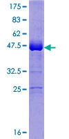 UBALD1 / FAM100A Protein - 12.5% SDS-PAGE of human FAM100A stained with Coomassie Blue