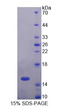 UBAP2 Protein - Recombinant Ubiquitin Associated Protein 2 By SDS-PAGE