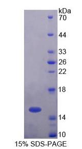 UBAP2 Protein - Recombinant Ubiquitin Associated Protein 2 By SDS-PAGE