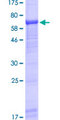 UBASH3A / CLIP4 Protein - 12.5% SDS-PAGE of human UBASH3A stained with Coomassie Blue