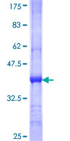 UBASH3A / CLIP4 Protein - 12.5% SDS-PAGE Stained with Coomassie Blue.