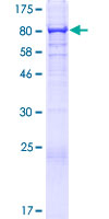 UBASH3B / STS-1 Protein - 12.5% SDS-PAGE of human UBASH3B stained with Coomassie Blue