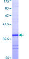 UBB / Ubiquitin B Protein - 12.5% SDS-PAGE Stained with Coomassie Blue.