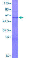 UBC6 / UBE2J2 Protein - 12.5% SDS-PAGE of human UBE2J2 stained with Coomassie Blue