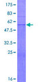 UBC6 / UBE2J2 Protein - 12.5% SDS-PAGE of human UBE2J2 stained with Coomassie Blue