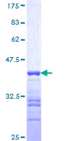 UBC6 / UBE2J2 Protein - 12.5% SDS-PAGE Stained with Coomassie Blue.