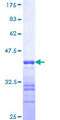UBC6 / UBE2J2 Protein - 12.5% SDS-PAGE Stained with Coomassie Blue.