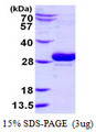 UBC6 / UBE2J2 Protein