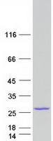 UBCH / UBE2H Protein - Purified recombinant protein UBE2H was analyzed by SDS-PAGE gel and Coomassie Blue Staining