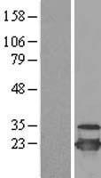 UBCH10 / UBE2C Protein - Western validation with an anti-DDK antibody * L: Control HEK293 lysate R: Over-expression lysate