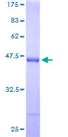 UBCH10 / UBE2C Protein - 12.5% SDS-PAGE of human UBE2C stained with Coomassie Blue