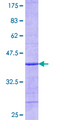 UBCH10 / UBE2C Protein - 12.5% SDS-PAGE Stained with Coomassie Blue.