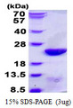 UBCH10 / UBE2C Protein