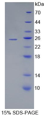 UBCH10 / UBE2C Protein - Recombinant  Ubiquitin Conjugating Enzyme E2C By SDS-PAGE