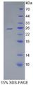 UBCH10 / UBE2C Protein - Recombinant  Ubiquitin Conjugating Enzyme E2C By SDS-PAGE
