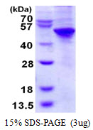 UBE1DC1 / UBA5 Protein