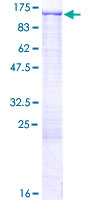 UBE1L / UBA7 Protein - 12.5% SDS-PAGE of human UBA7 stained with Coomassie Blue