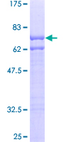 UBE1L2 / UBE1L2 Protein - 12.5% SDS-PAGE of human FLJ10808 stained with Coomassie Blue