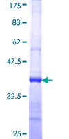 UBE1L2 / UBE1L2 Protein - 12.5% SDS-PAGE Stained with Coomassie Blue.