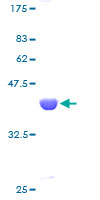UBE2A Protein - 12.5% SDS-PAGE of human UBE2A stained with Coomassie Blue