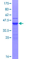 UBE2D1 / UBCH5 Protein - 12.5% SDS-PAGE of human UBE2D1 stained with Coomassie Blue