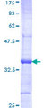 UBE2D1 / UBCH5 Protein - 12.5% SDS-PAGE Stained with Coomassie Blue.