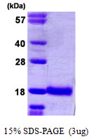 UBE2D1 / UBCH5 Protein