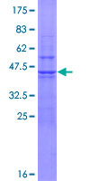 UBE2D2 / UBCH5B Protein - 12.5% SDS-PAGE of human UBE2D2 stained with Coomassie Blue
