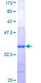 UBE2D2 / UBCH5B Protein - 12.5% SDS-PAGE Stained with Coomassie Blue.