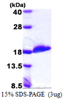 UBE2D2 / UBCH5B Protein