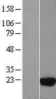 UBE2D3 / UBCH5C Protein - Western validation with an anti-DDK antibody * L: Control HEK293 lysate R: Over-expression lysate