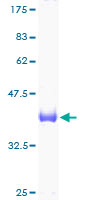 UBE2D3 / UBCH5C Protein - 12.5% SDS-PAGE of human UBE2D3 stained with Coomassie Blue