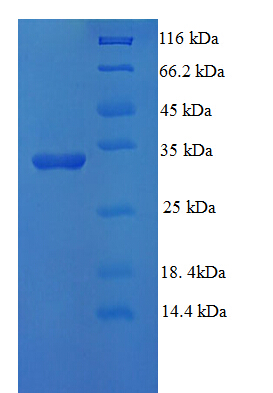 UBE2D3 / UBCH5C Protein