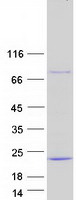 UBE2D3 / UBCH5C Protein - Purified recombinant protein UBE2D3 was analyzed by SDS-PAGE gel and Coomassie Blue Staining
