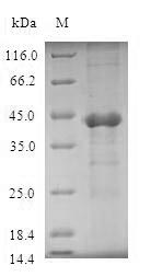UBE2D4 Protein - (Tris-Glycine gel) Discontinuous SDS-PAGE (reduced) with 5% enrichment gel and 15% separation gel.