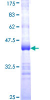 UBE2D4 Protein - 12.5% SDS-PAGE Stained with Coomassie Blue