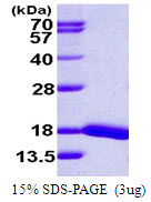 UBE2D4 Protein