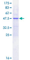 UBE2E1 / UBCH6 Protein - 12.5% SDS-PAGE of human UBE2E1 stained with Coomassie Blue