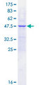 UBE2E1 / UBCH6 Protein - 12.5% SDS-PAGE of human UBE2E1 stained with Coomassie Blue