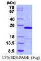 UBE2E1 / UBCH6 Protein
