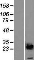UBE2E2 / UBCH8 Protein - Western validation with an anti-DDK antibody * L: Control HEK293 lysate R: Over-expression lysate