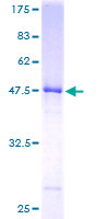 UBE2E2 / UBCH8 Protein - 12.5% SDS-PAGE of human UBE2E2 stained with Coomassie Blue